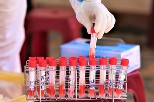 Quảng Nam: Tạm dừng yêu cầu phải xét nghiệm virus SARS-CoV-2 trước khi nhập cảnh