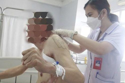 Người đàn ông Quảng Ninh lở loét, sẹo khắp người vì mồ hôi tiết ra mủ hiếm gặp