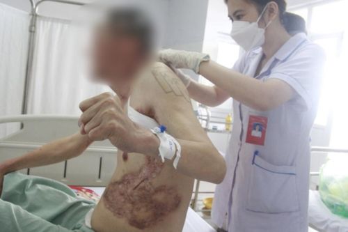 Người đàn ông bị lở loét, sẹo khắp người vì mồ hôi tiết ra mủ hiếm gặp