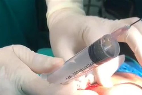 Làm đẹp để đổi 'phong thủy': Nhiều ca biến chứng, nhập viện