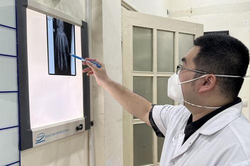 Điện thoại phát nổ khi vừa sạc vừa chơi điện tử, thanh niên bị cụt, dập nát nhiều ngón tay