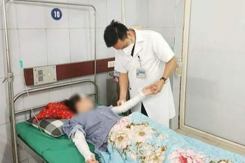 Nữ sinh bỏng nặng do bóng bay nổ trong tiệc sinh nhật