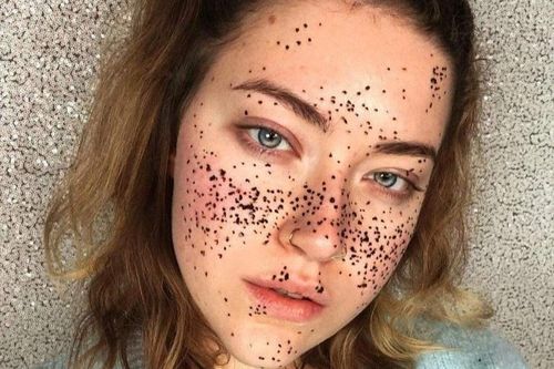 Trào lưu vẽ tàn nhang trên TikTok bị chỉ trích