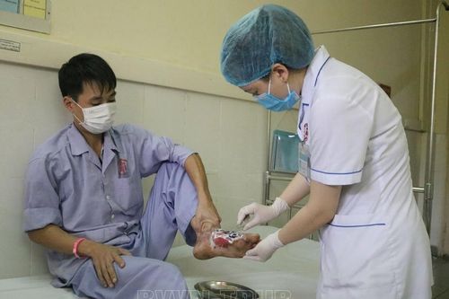 Hoại tử bàn chân do chữa bỏng bằng lông gà và thuốc 'lạ'