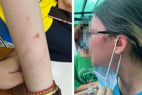 Vụ bạo lực trong trường quốc tế: Ủy ban nhân dân TPHCM chỉ đạo khẩn