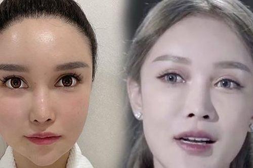 Chi 13 tỷ đồng thẩm mỹ từ lúc 14 tuổi, hot girl hàng đầu 1 thời bỗng ân hận