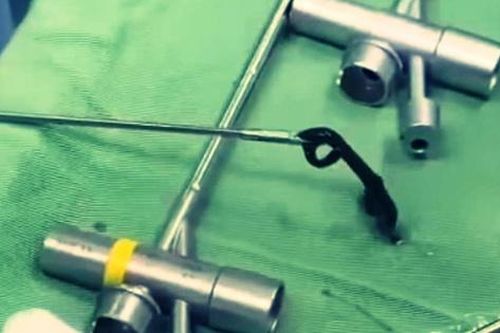 Kinh hãi vắt rừng dài 8cm 'trốn' trong đường thở của bé 6 tuổi