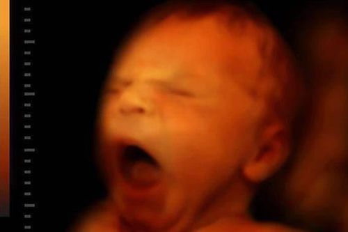 Em bé trong bụng mẹ 90% thời gian là ngủ, thức dậy lại làm 'đủ trò' cực đáng yêu
