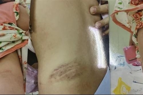 Đừng bắt những đứa trẻ phải tự chống đỡ