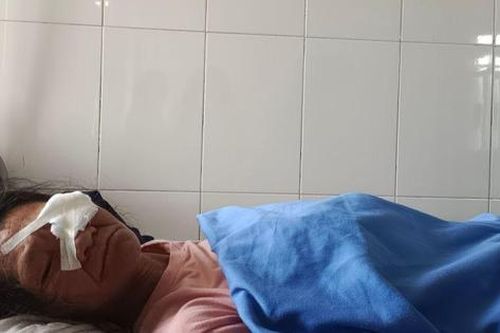 Người phụ nữ suýt mù vì đất văng vào mắt