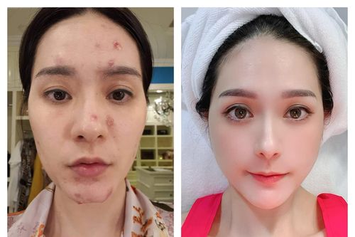 Lộ gương mặt chi chít lỗ 'nữ đại gia quận 7' làm netizen sợ