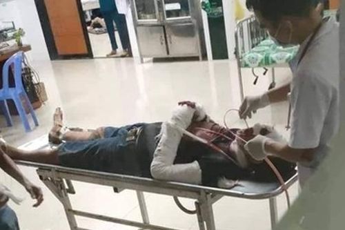 Đâm người xong ngồi chờ Công an đến bắt
