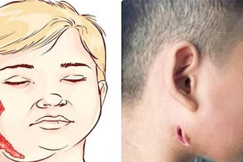 BS Trương Hữu Khanh nói về căn bệnh bị gọi tên 'vi khuẩn ăn thịt người'