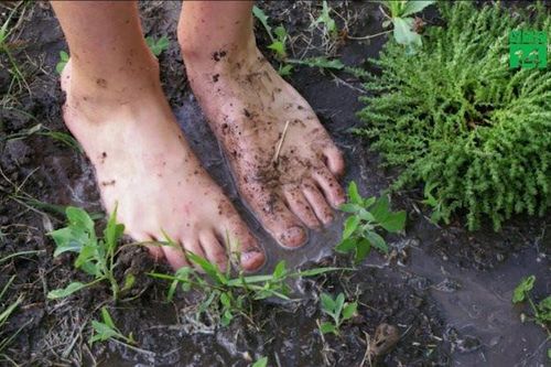 Bé 9 tuổi ở Đắk Lắk mắc 'vi khuẩn ăn thịt người'