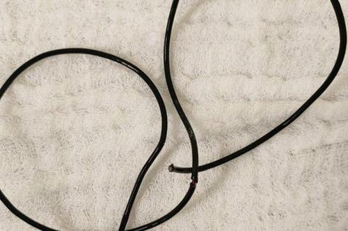 Nam thanh niên tự nhét đoạn dây tai nghe 20cm vào niệu đạo