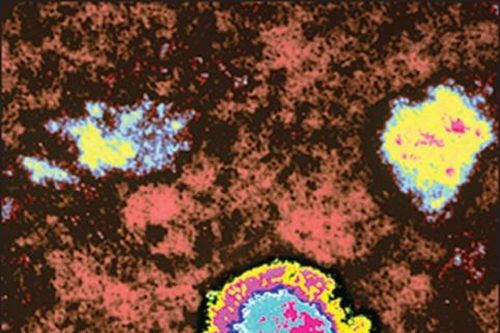Virus hiếm gây tử vong gần 100% 'tái xuất'