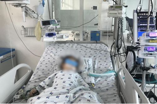 Bị dây ba lô quấn cổ, bé 2 tuổi suy hô hấp thiếu oxy não nhập viện khẩn cấp