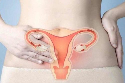 Bé trai chào đời từ người mẹ bị ung thư cổ tử cung