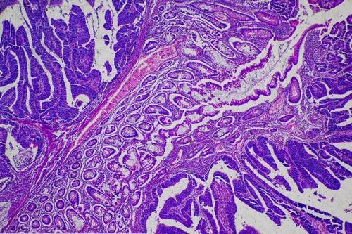 Trước Dostarlimab, thuốc ung thư được nghiên cứu thế nào?