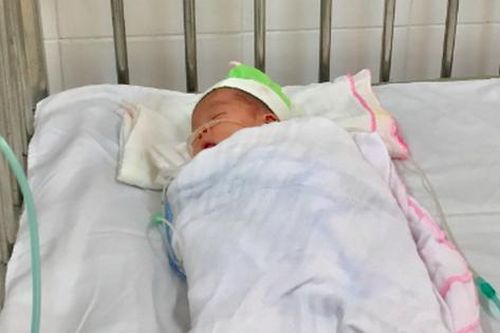 Bé sơ sinh bị uốn ván, co cứng toàn thân sau sinh tại nhà