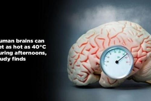 Bản đồ 4D đầu tiên về nhiệt độ não người