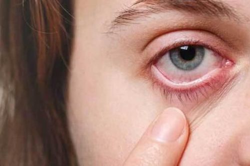 Phát triển thuốc điều trị u ác tính màng bồ đào