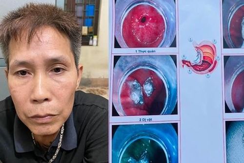 Gặp Công an, nuốt ma túy phi tang
