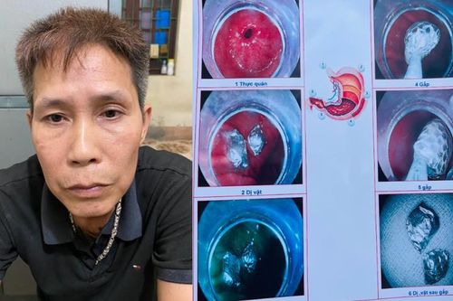 Gặp công an, nuốt luôn ma túy phi tang