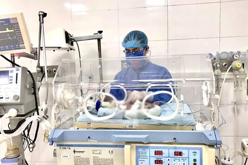 Bé sinh non nặng 1,6kg suy hô hấp, nhiễm khuẩn sơ sinh nặng được cấp cứu khẩn