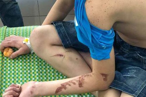 30 tháng tù giam cho chủ quán bánh xèo tra tấn nhân viên như thời Trung cổ