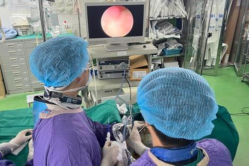 Loại bỏ hoàn toàn sỏi mật phức tạp chỉ với 1 lỗ nhỏ trên da
