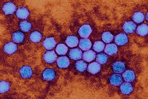 Virus bị xóa sổ gần 50 năm trước bất ngờ 'tái xuất' ở Anh