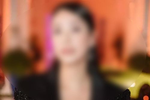 Lại thêm một người đẹp của showbiz Việt xuất hiện với gương mặt đơ cứng, môi sưng vù