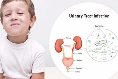 Nhiễm trùng đường tiểu ở trẻ: Dấu hiệu, nguyên nhân, biến chứng và điều trị