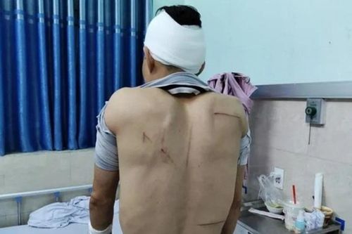 Nghi va chạm giao thông, một người đàn ông bị nhóm côn đồ cầm hung khí tấn công trước cửa bệnh viện