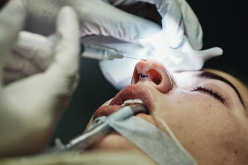 Liều mình nâng mũi, hút mỡ ở nước ngoài bất chấp rủi ro