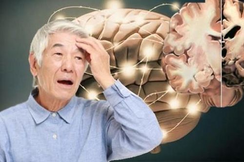 Trong 30 năm nữa, số trường hợp sa sút trí tuệ sẽ tăng gấp ba lần