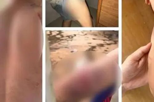 Vụ cháu bé 9 tuổi bị đánh đập dã man: Rùng mình nghe lời kể của nạn nhân!