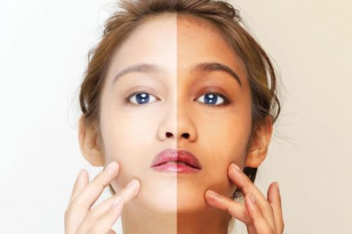 Kem trộn tràn lan vì nỗi ám ảnh về làn da trắng