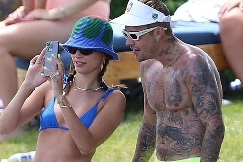 Justin Bieber sau khi liệt cơ mặt
