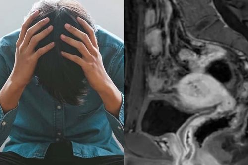 Người đàn ông bị sốc khi biết mình có buồng trứng, tử cung và kinh nguyệt hàng tháng