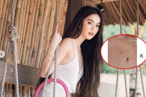 Ngọc Trinh gặp sự cố nghiêm trọng ở vùng bụng khi đóng phim, netizen hết lời khen ngợi về khoản này!