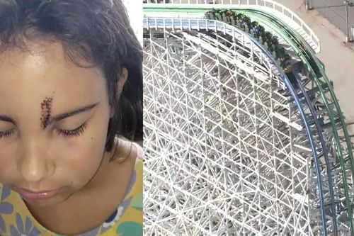 Bé gái phải khâu 10 mũi vì đi tàu lượn siêu tốc ở Mỹ
