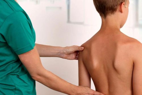 Bé trai 6 tuổi có nguy cơ không thể ngồi vào bàn học do vẹo cột sống