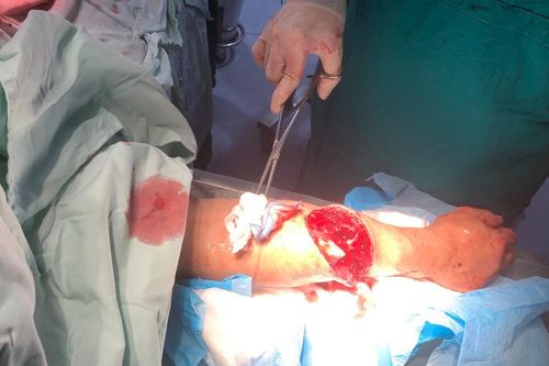 Bị hàng xóm dùng dao đâm chém, 1 người chết, 2 người nguy kịch