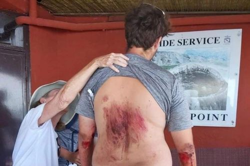 Du khách Mỹ rơi vào miệng núi lửa vì chụp ảnh selfie
