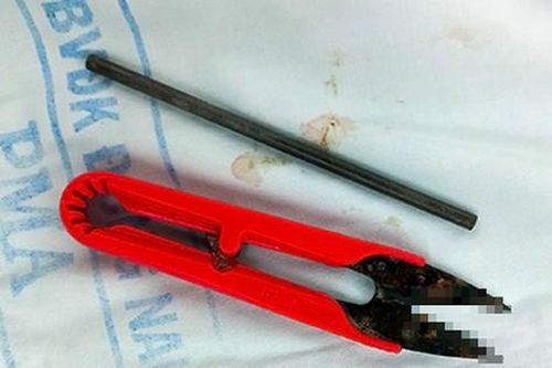 Chiếc kéo cắt chỉ và thanh kim loại trong dạ dày