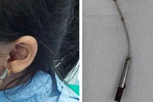 Từ vụ bé 6 tuổi gặp nạn khi được lấy ráy tai, cảnh báo thói quen gây hại tai con nhiều cha mẹ mắc phải