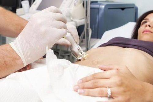 Chảy máu đường mật và những nguy biến 'khó đỡ'