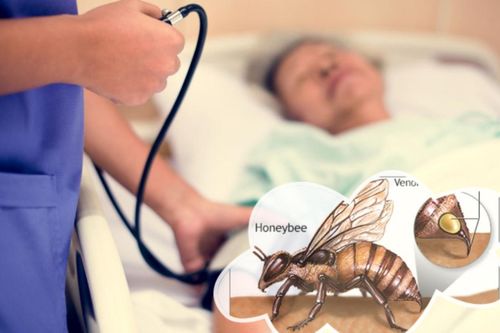 Sau khi bị ong đốt, người phụ nữ bất ngờ bị đột quỵ, nhập viện khẩn